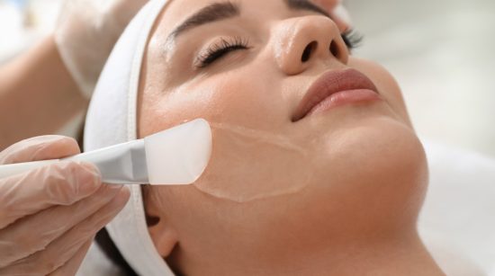 Consider a Chemical Peel